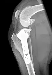 TPLO x-ray